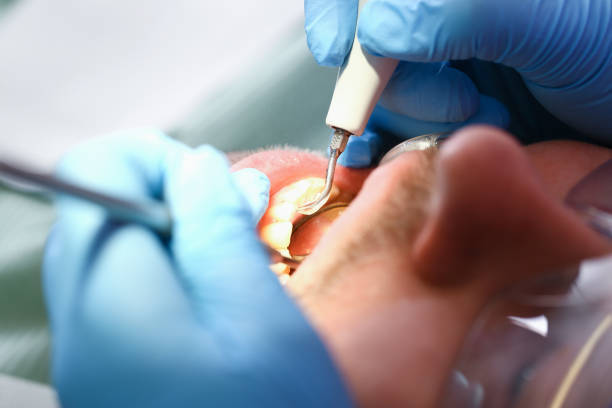 Best Knocked-Out Tooth Emergency  in Albers, IL