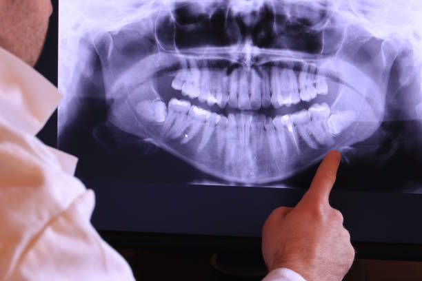 Best Broken Tooth Emergency  in Albers, IL