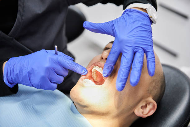 Best Chipped Tooth Repair Near Me  in Albers, IL